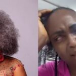 Yeni Kuti Supports Blessing CEO Amid Cancer Test Controversy: “I Pray She Has It So She Can Be Healed”